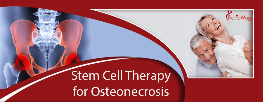 Stem Cell Therapy for Osteonecrosis